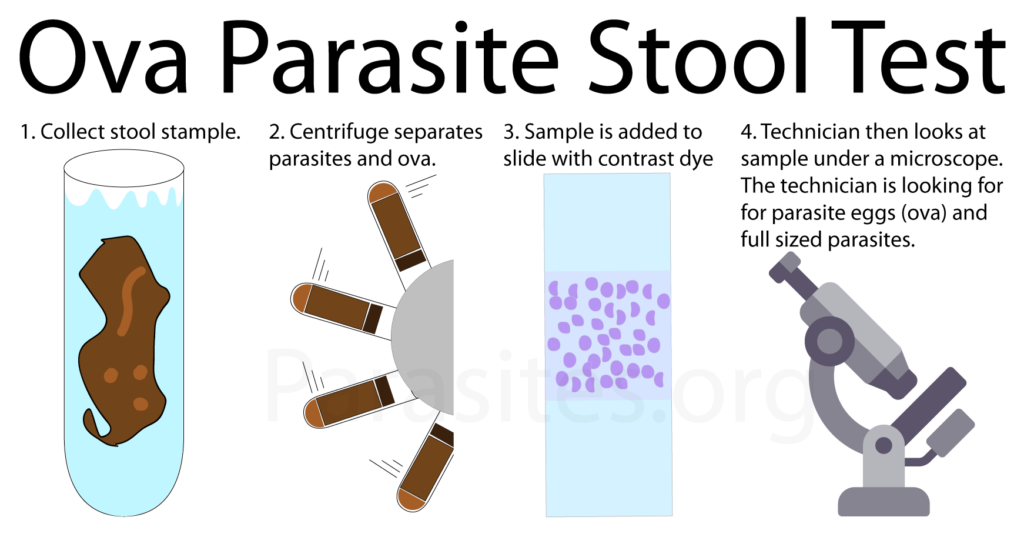 Ova Parasite Stool Test Accuracy - Guide for Patients - Parasites.org