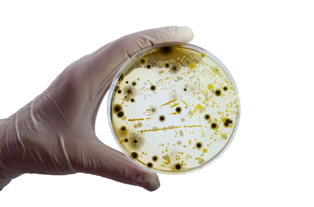 a picture of a gloved hand holding a petri dish