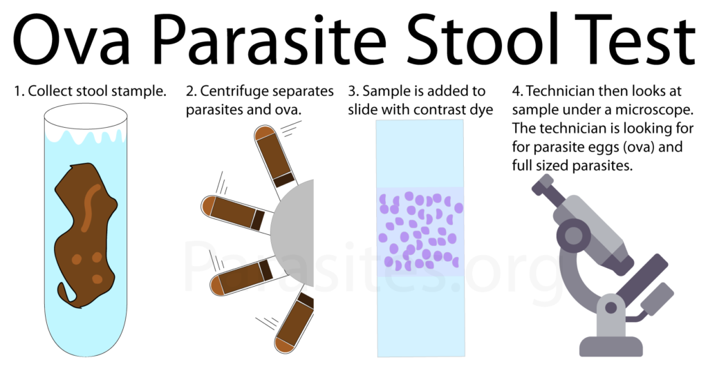 ova-parasite-stool-test-large-1024x537