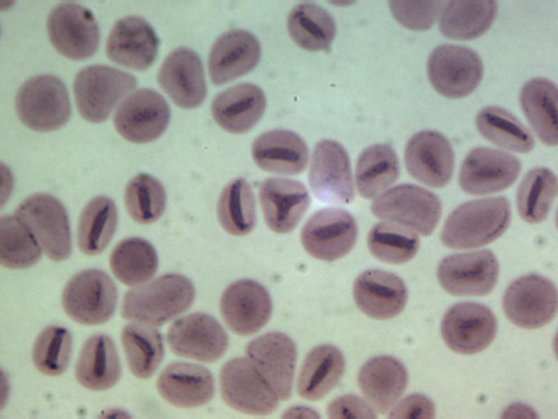 Malaria parasite in a blood smear