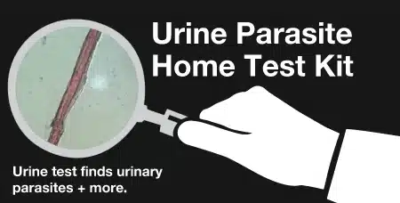 Urine Test